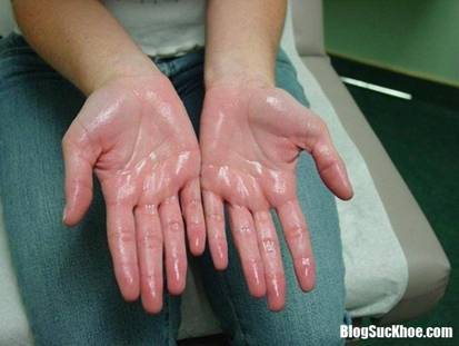 nhung dau hieu tiem an chung to co the ban dang mac benh 6216b7 Triệu chứng đột quỵ v� nhiều bệnh nguy hiểm xảy ra h�ng ng�y