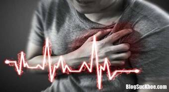 Mac ung thu hai tim tang nguy co dot quy vi ngu trua ngay sau khi an 2 1554951426 143 width650height353 Ngủ trưa ngay sau khi ăn g�y ra v� số bệnh chết người